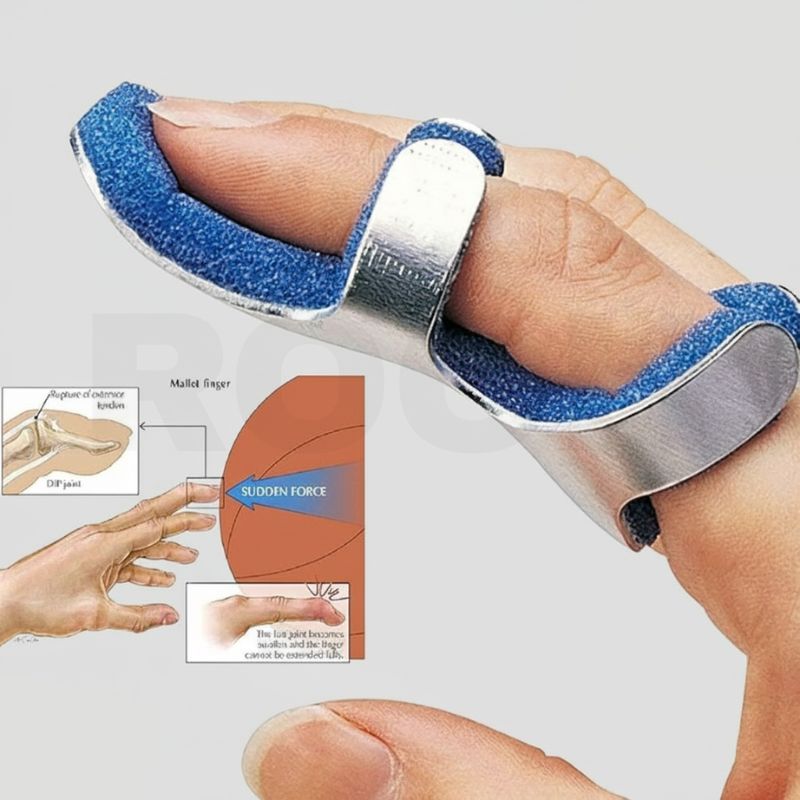 Finger Splints & Braces  Adjustable, Custom